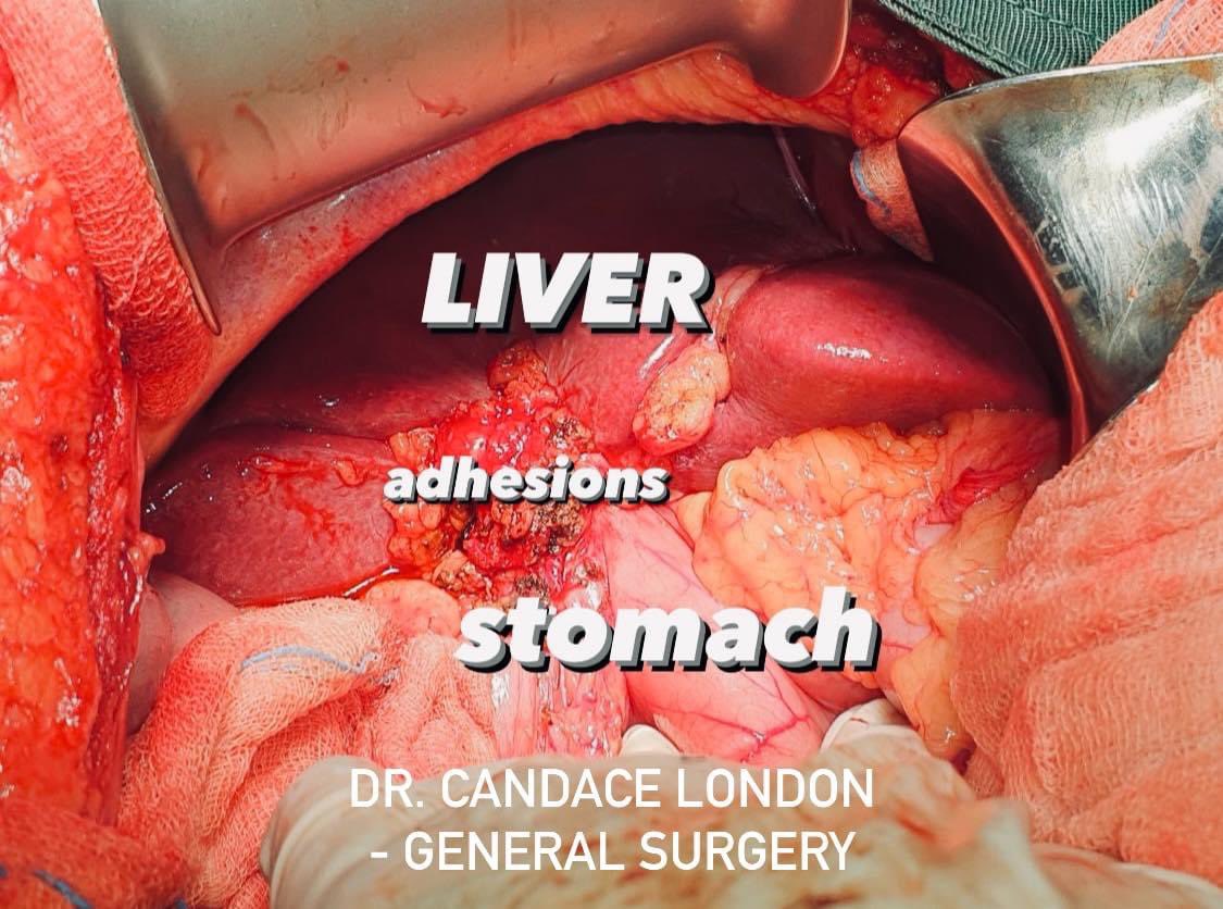 Dr. Candace London - General Surgery tweet media