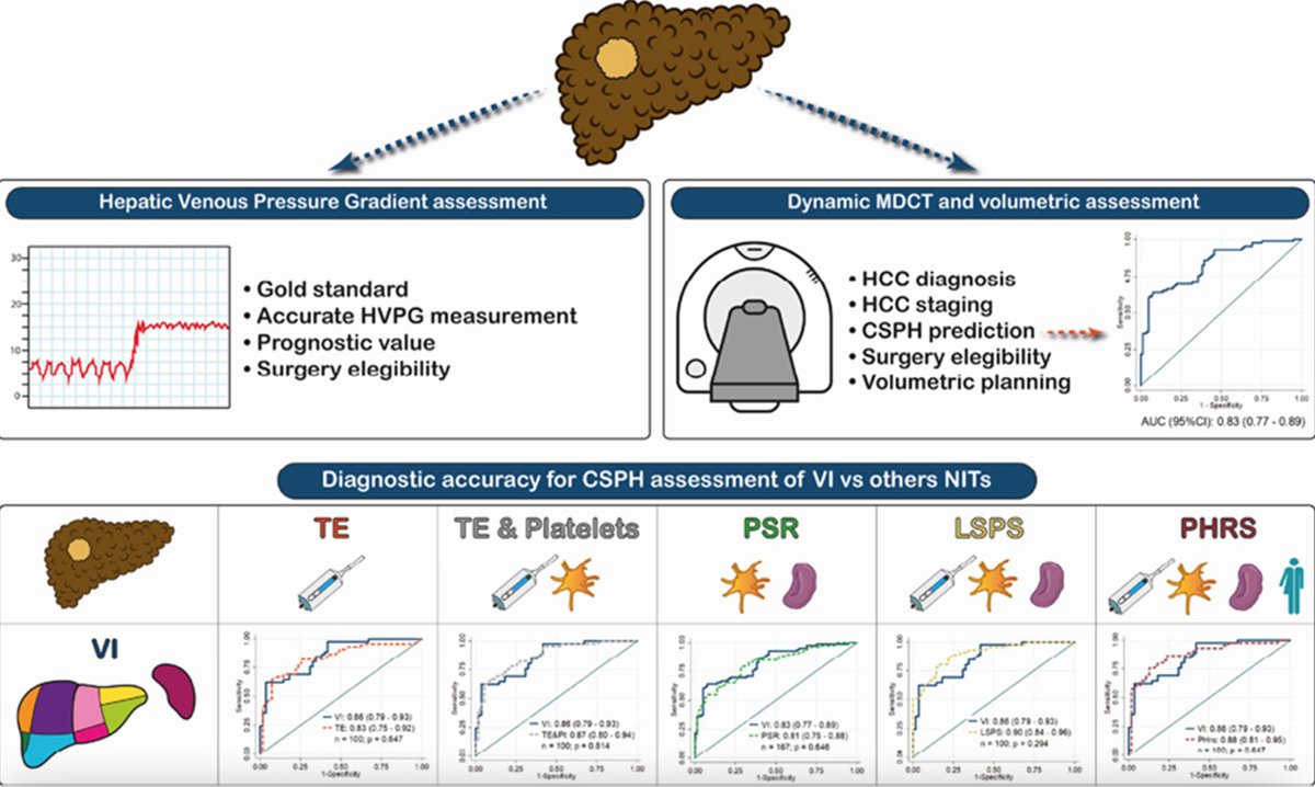 CT-derived liver and spleen volume accurately diagnose clinically significant portal hypertension in patients with hepatocellular carcinoma. Published in <a href="/JHEP_Reports/">JHEP Reports</a>. 

 By Drs. Agustín Albillos, <a href="/luistevilla/">Luis Téllez</a>, <a href="/salonsol_/">Sonia Alonso</a> et al.

sciencedirect.com/science/articl…
#livertwitter