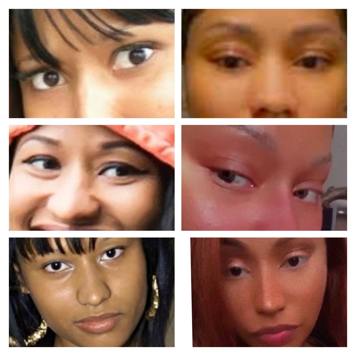 FEMALE RAP BIBLE on Twitter "She's had her hooded eyes lifted, bridge