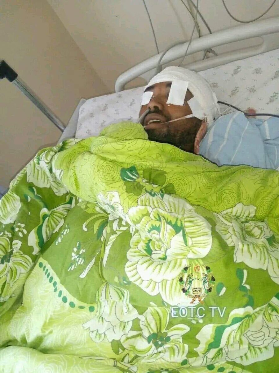 Ayalew Terefe, an Orthodox youth, who has been receiving treatment in Hawassa after he was brutally bludgeoned with sticks by a mob led by law enforcement agents in Shashemene in West Arsi Diocese has departed as a martyr on this day.#orthodoxunderattackinEthiopia