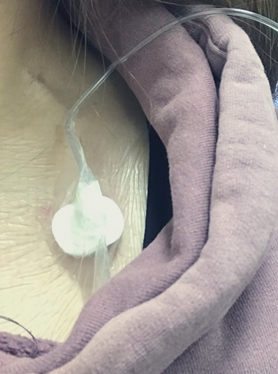 hisa_0924's tweet photo. お疲れ様です

昨日は仕事も大変やし会議も最悪💦
体調も崩し疲れ果ててました😭
何もかも嫌になってました💦

今日は通院で休み
仕事から少し離れ気持ちも落ち着きました
とりあえず
腹痛、低体温何とかしよっ💦
頑張らなきゃ

Day.160-161
 #コラージュ #キイトルーダ #ポート https://t.co/vl6Rnta9tg