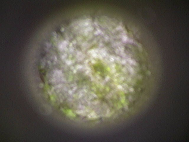 HC_PinnaClear's tweet photo. Ever wondered what a normal eardrum looks like? Around this time many people feel blocked and quite often it isn't wax but fluid build-up behind the eardrum. Steam and a nasal spray can help. #hearing #syringing #mcr #trafford #microsuction #pinnaclear #Health https://t.co/22Y9wczYBl