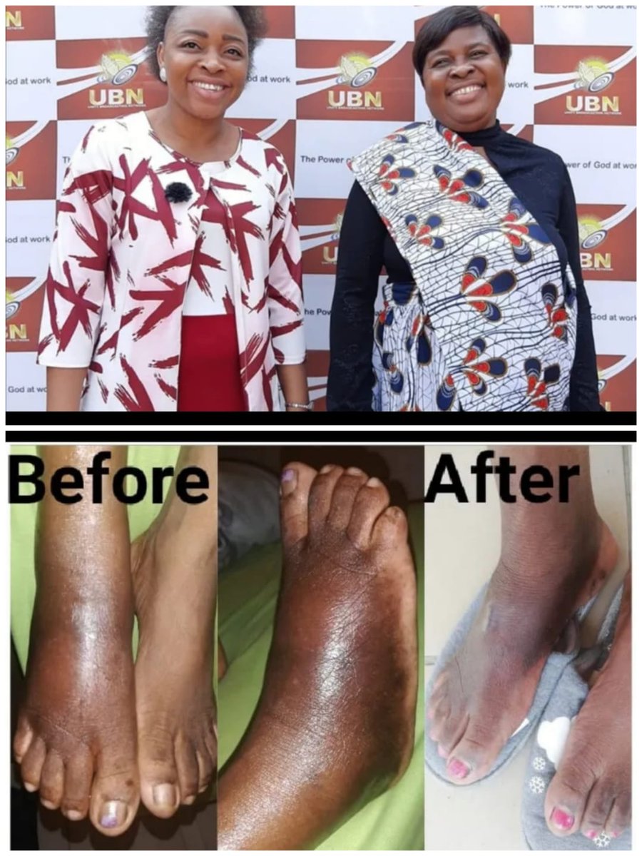 MoyanaVongani's tweet photo. #UBNPowerWeekend
#Kuzokhanya 
@PastorMukhuba. My mother got sick. When she went to the doctors, they couldn't see the cause of her sickness. She couldn't walk on her own. She was using crutches. She received her complete healing at Pastor Mukhuba's church. https://t.co/T3FTSePkdG