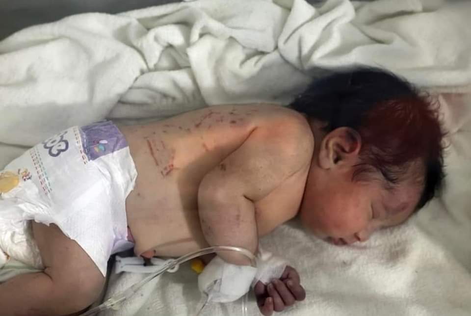 هذه هي الطفلة المعجزة التي ولدت تحت الانقاض خلال الزلزال الذي ضرب مدينة سوريا وبقيت حيّة في حالة مستقرّة فيما توفي جميع أفراد عائلتها بمن فيهم والدتها