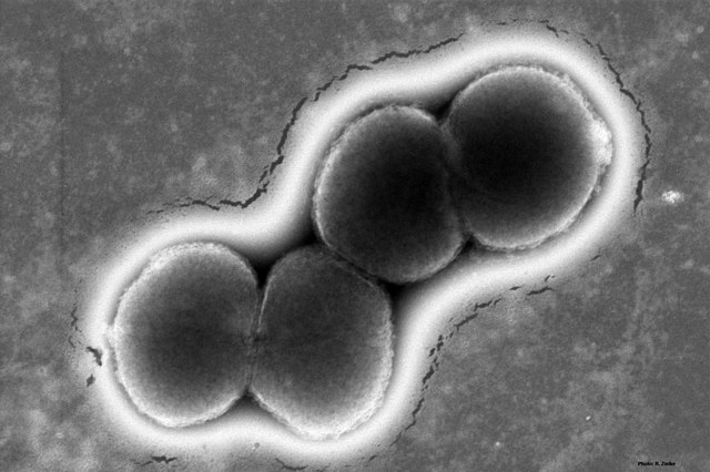 #MicrobeoftheMonth! Can you guess who I am?

1. I cause a sexually transmitted infection.
2. I use phase variation to alter proteins on my surface.
3. I only naturally infect humans. 

Comment your guess below and stay tuned for the big reveal!