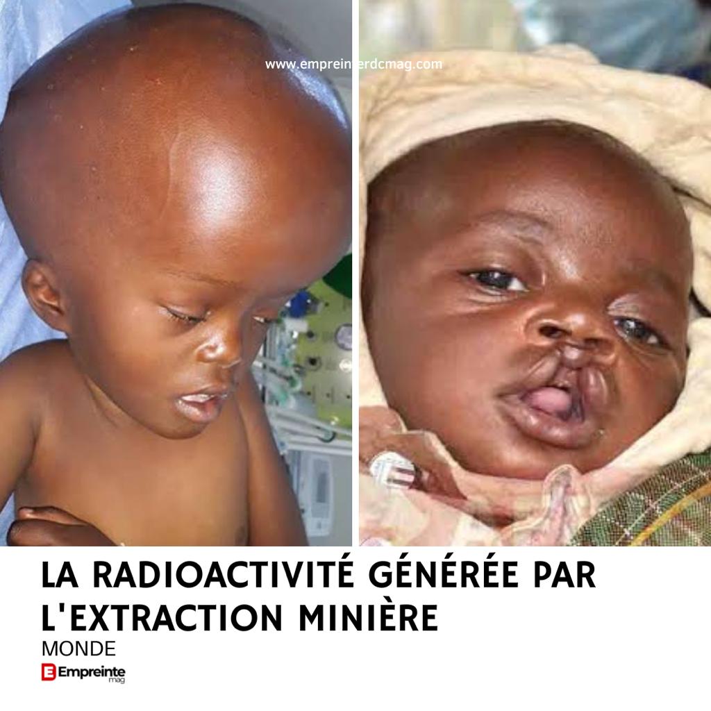 EmpreinteRdc's tweet photo. Peu de Congolais connaissent les rudiments de l'extraction minière alors que plusieurs personnes peuvent être touché par la radioactivité. Notamment les proches des mineurs qui ont manifesté des symptômes,certains de leurs enfants  naissants avec des malformations congénitales. https://t.co/bZrKfWeKz1