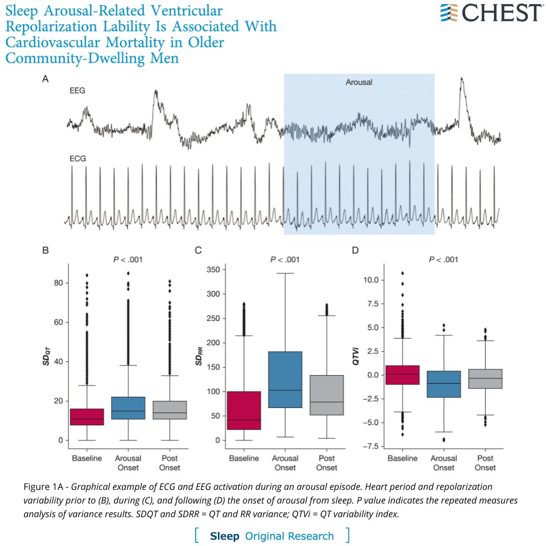 Does excessive arousal burden affect cardiac repolarization? Read the full original research in the February issue to find out: hubs.la/Q01BsQ5H0
#JournalCHEST #CHESTSleep #MedEd