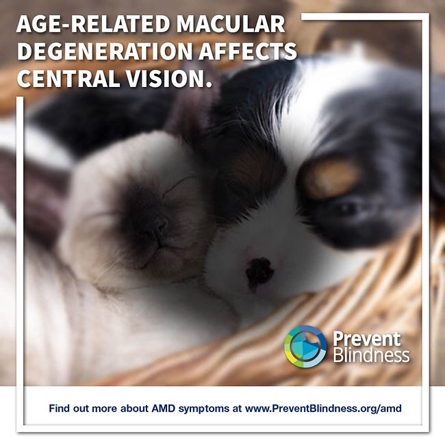 #WellnessWednesday:
Repost from @preventblindnesstexas - Signs of Age-related Macular Degeneration (AMD) become more obvious the longer you have the disease. If you have AMD, you may notice that a dark or empty spot may block the center of your vision.