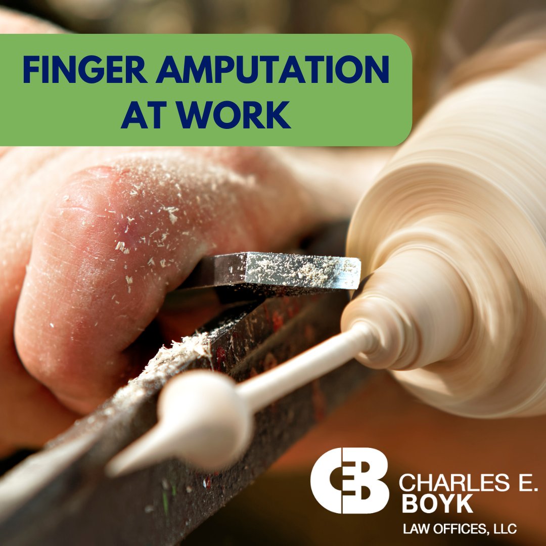 While on the job, our client's hand was pulled into a lathe machine, amputating his finger. Check out our blog to read his story and others: loom.ly/D_Y0z5k 
#machine #blog #story #injury #read #lathemachine #injuryattorney #workerscompensation #worker #charlesboyklaw