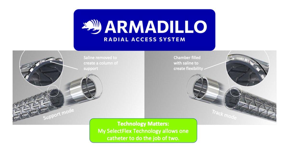 q_apel's tweet image. My SelectFlex technology enables me to change properties so I can navigate even the most delicate tortuosity, providing a tremendously stable platform. 
#SelectFlex #backtobiaxial #radialaccess #technologymatters