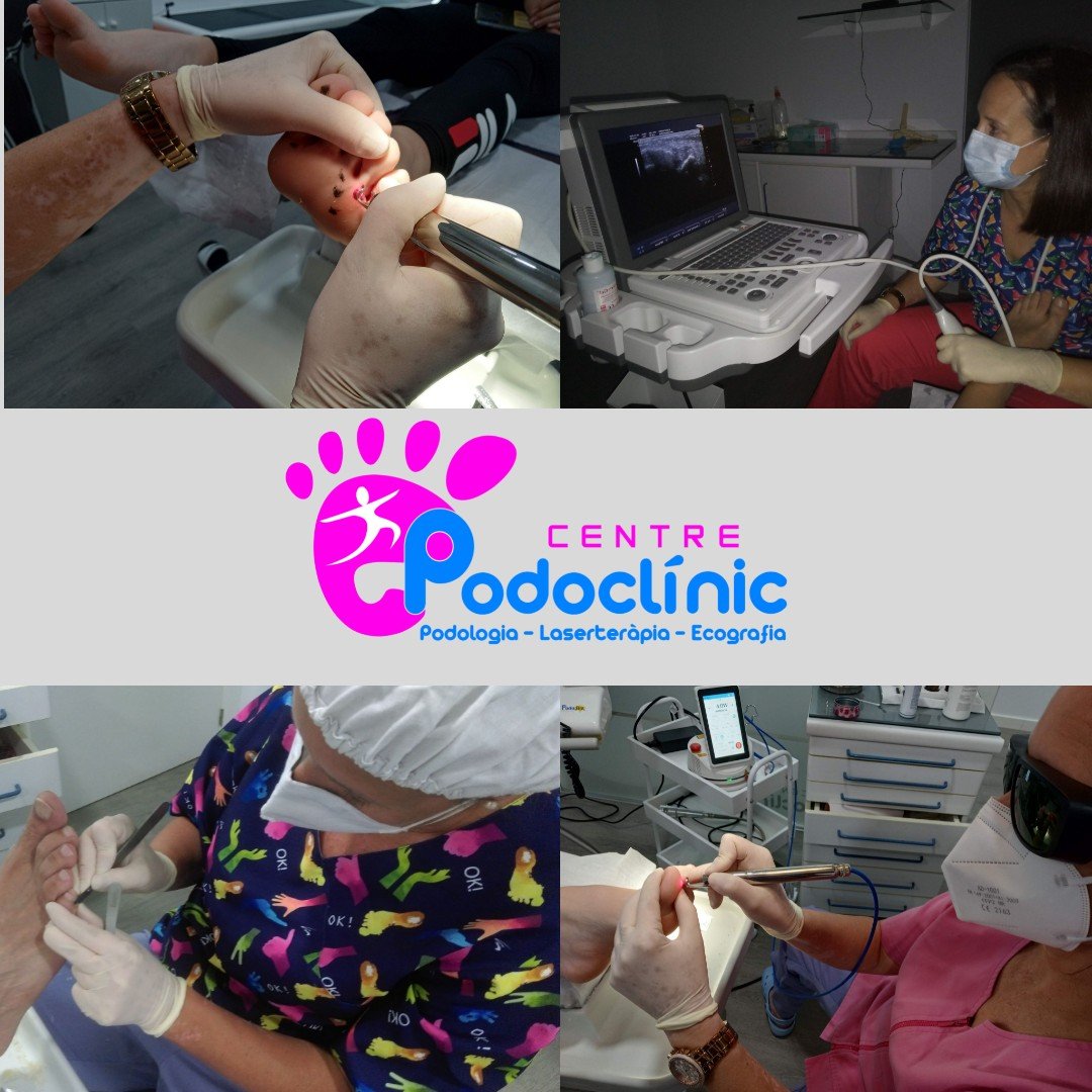😭Problemes als peus?🦶🏻🦶🏻
👉🏻La teua solució és el Centre Podoclínic ; especialitzats en podologia:⬇️⬇️⬇️
✅Infantil.
✅Esportiva.
✅Laserteràpia.
✅Ecografia.
🤔 Centre Podoclínic , carrer València núm. 9 baix. Tavernes de la Valldigna.
📞96 282 25 62.
📲607 26 97 97