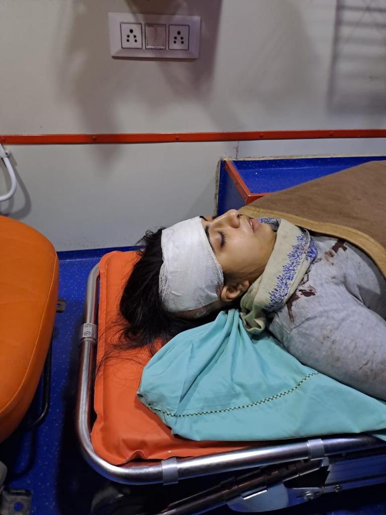 shruti_garg0104's tweet photo. Blue Baleno hit-and-run near Noida Sec 51 metro last night leaving our friend with open head wound,fighting for her life.4 hrs of brain-surgery, still unconscious.Perpetrators roam free. Authorities,please act!. @wpl1090 @CP_Noida @myogiadityanath @noidapolice  @PMOIndia https://t.co/3M5aHhjhuT