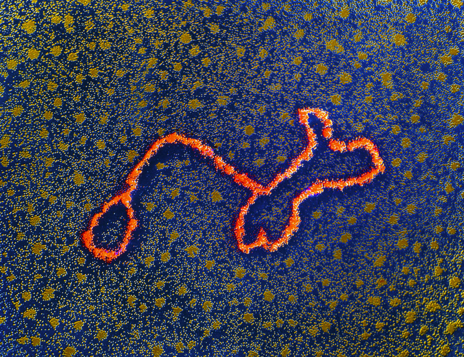 SciImmunology's tweet photo. While exploring how splicing junctions between exons and transposable elements contribute to tumor-specific antigens, scientists found that the histone methyltransferase Setdb1 epigenetically controls their expression in mice. @institut_curie

📄: https://t.co/AuNpn9KjNN https://t.co/2PtWV9jM3p