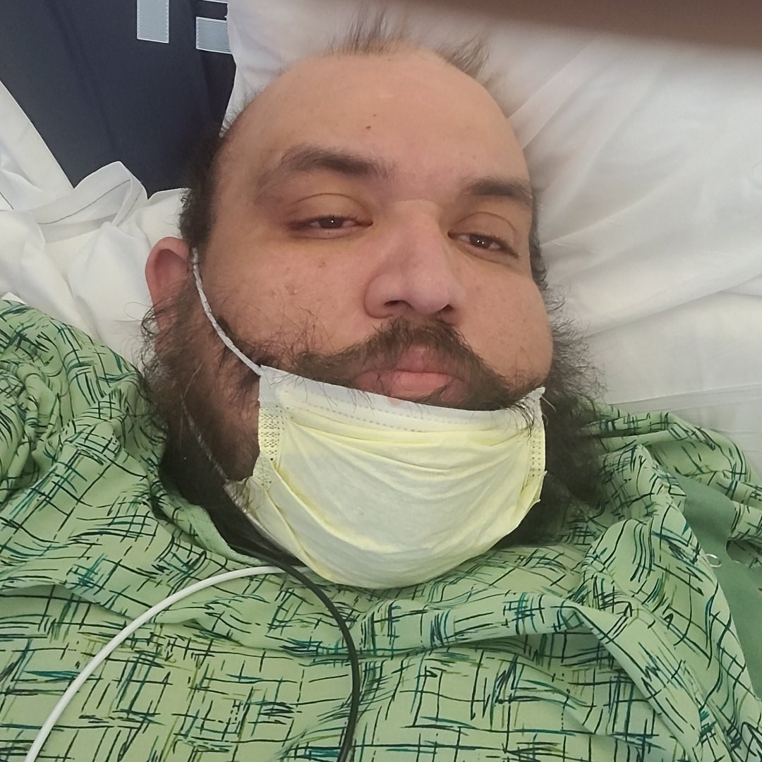 ashtrayofla's tweet photo. @MrBeast Hey @MrBeast Buy my body parts b4 they fall off? a idea submission https://t.co/KmNuoHnhkD