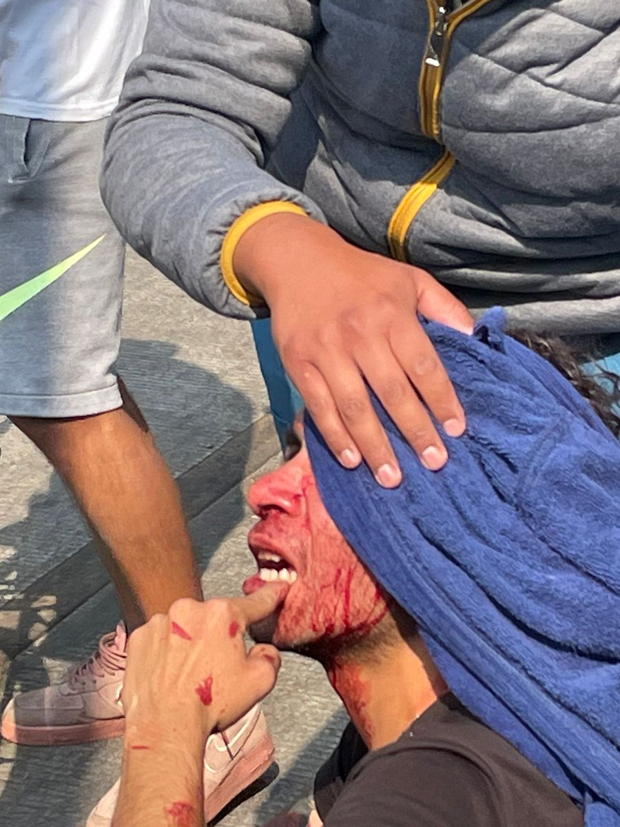 evedian26's tweet photo. Un par de comerciantes golpeó salvajemente a nuestro compañero por pedir la liberación de la CV @mauriciotabe @UCS_GCDMX  urge se tomen acciones para garantizar el paso dentro de la Ciclovía de #MaestroRural usaron incluso una botella de vidrio. https://t.co/niTlg8sSbi
