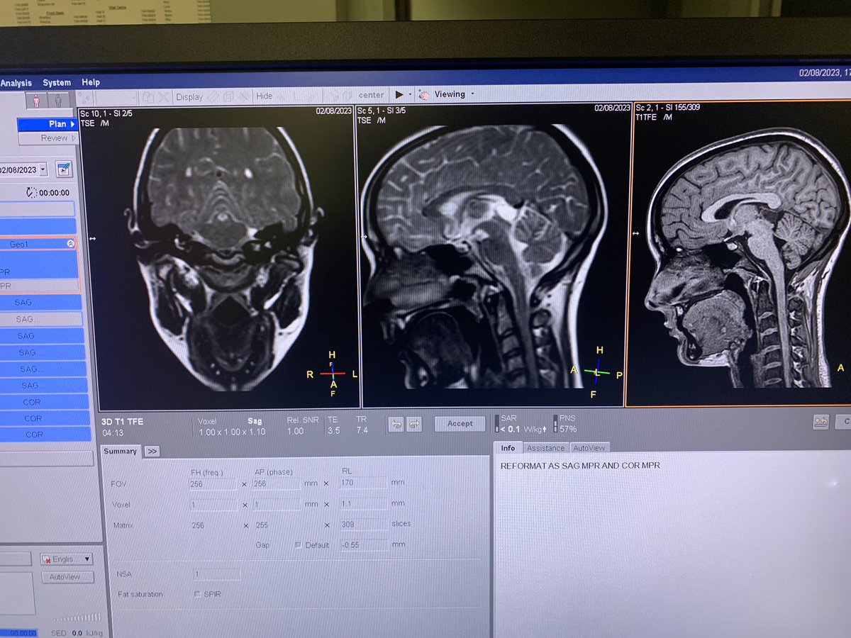 PerryLab_'s tweet photo. Lab member Megan Bowling served as our most recent test subject when setting up a new MRI site in Greenville, NC. Live locally and know a 5-8 year old? Let us know; we are paying $100 per scan session! https://t.co/2cbRbeagPH