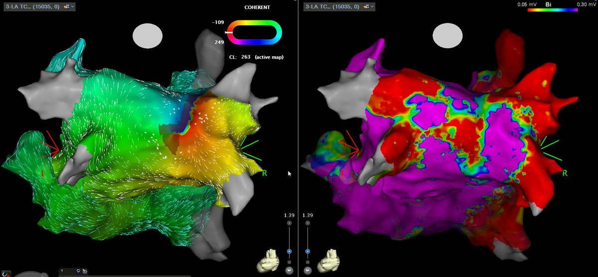 RDUH Electrophysiology Team tweet media
