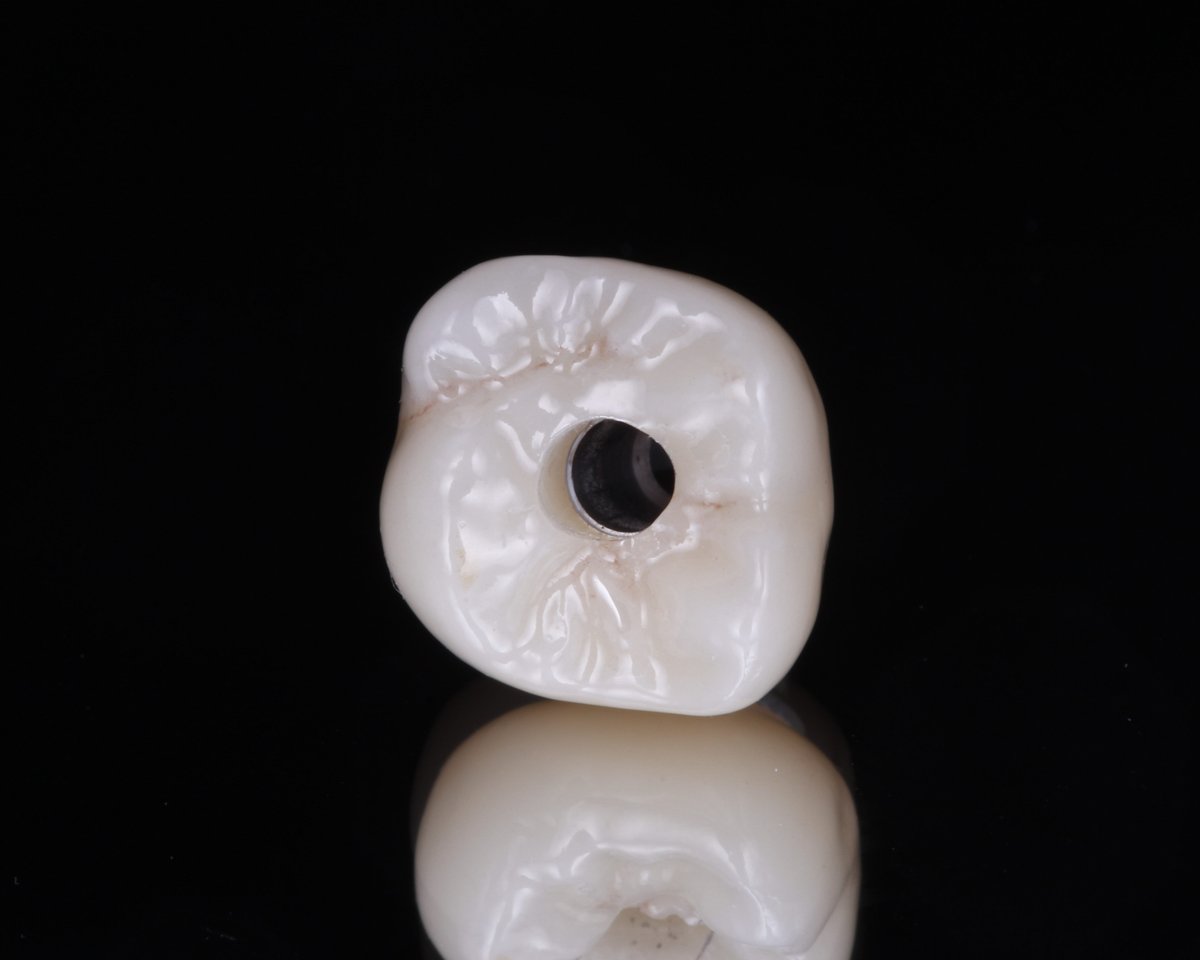 Hallmark Dental Lab tweet media