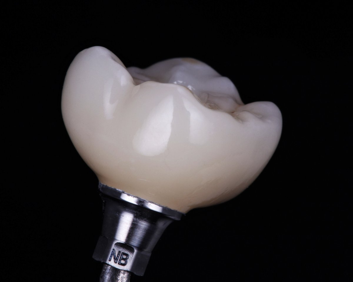 Hallmark Dental Lab tweet media