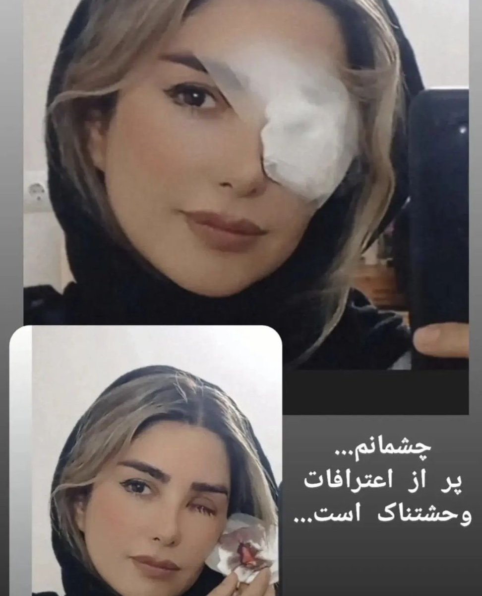 Shadi7780's tweet photo. For our children who lost their eyes forever in the hands of the criminals of the Islamic Republicof Iran.
#IranRevoIution
#boycotIRIday
#IRGCterorrists
#WomanLifeFreedom https://t.co/9EnUKGu9bR