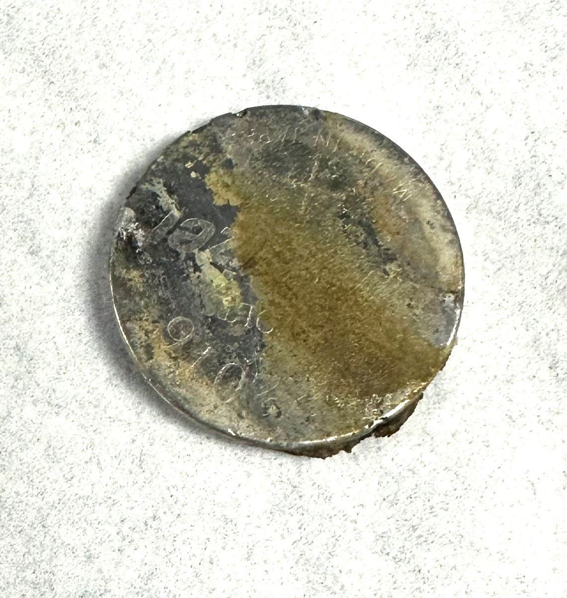 David Diehl (@daviddiehlmd) on Twitter photo A reminder that button battery ingestion requires urgent intervention! The patient swallowed it 7 hours before coming in; this ulcer may have perforated if there was a longer delay! The battery got held up at the level of the aortic knob #GITwitter <a href="/ASGEendoscopy/">ASGE GI Endoscopy</a> <a href="/DouglasAdlerMD/">Douglas G. Adler MD, FASGE, FACG, AGAF</a> A reminder that button battery ingestion requires urgent intervention! The patient swallowed it 7 hours before coming in; this ulcer may have perforated if there was a longer delay! The battery got held up at the level of the aortic knob #GITwitter <a href="/ASGEendoscopy/">ASGE GI Endoscopy</a> <a href="/DouglasAdlerMD/">Douglas G. Adler MD, FASGE, FACG, AGAF</a>