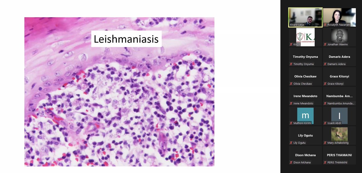 MGHPathology's tweet photo. Rosalynn Nazarian, MD (@RosNazarianMD) and Alvaro Laga Canales, MD, MSC (@BWHPath) presented CME sessions to the Kenya Association of Clinical Pathologists (@KenyaKacp). 🔬🗣️🖥️

Inflammatory &amp; Neoplastic #Dermatopathology: Instructive Cases from the MGB.

#DermPath #Pathology https://t.co/KBiZ3Qboqe