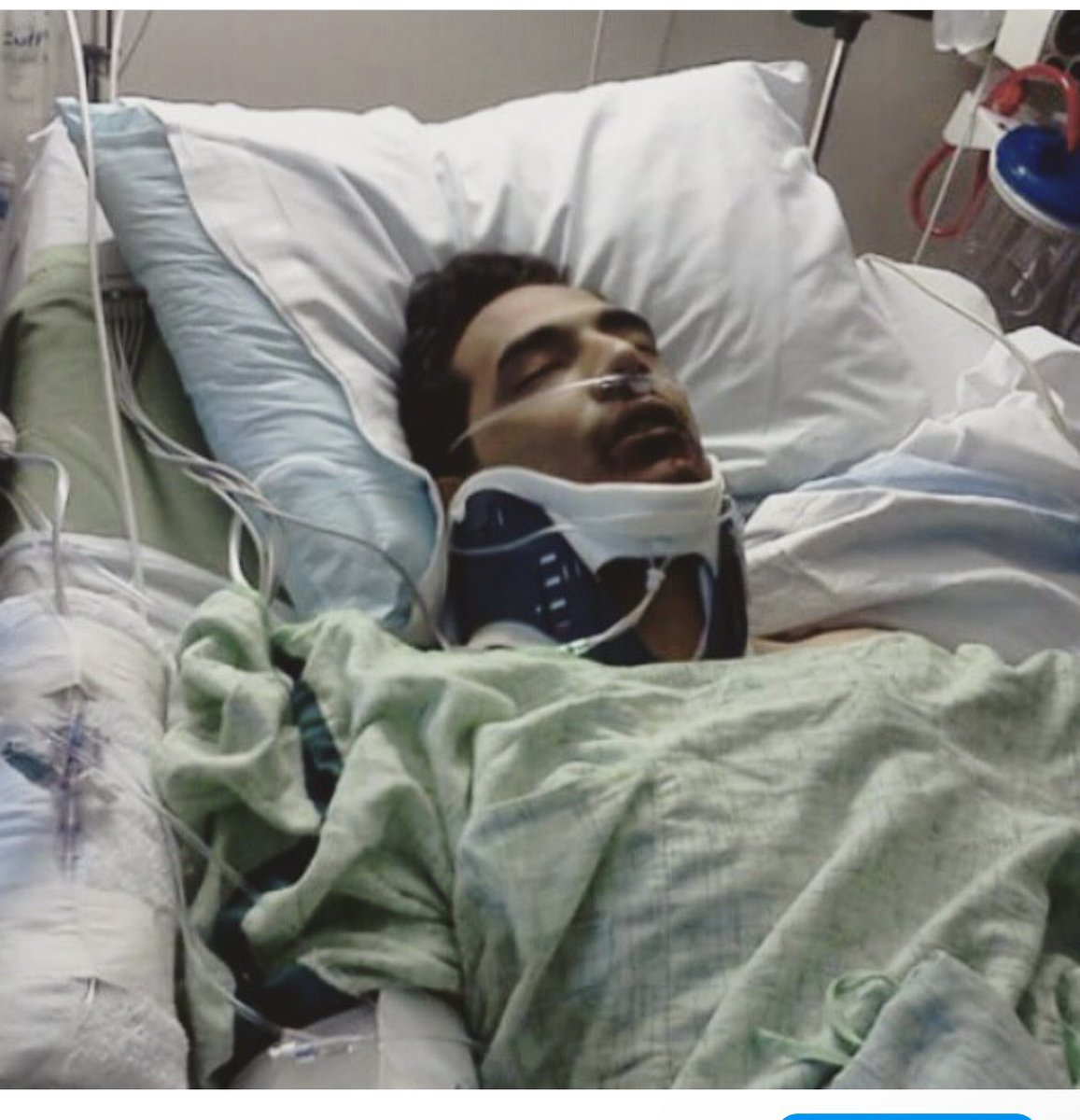 CaliSmoov4Life's tweet image. On this day i woke up on life support #feb7 had emergency heart surgery, broke multiple bones &amp;amp; lost my closest friends BJ &amp;amp; TIm 🙏🏼💙 I still think about you guys every day and pray for your souls. Nobody will ever understand the trauma i had to overcome &amp;amp; still deal with daily