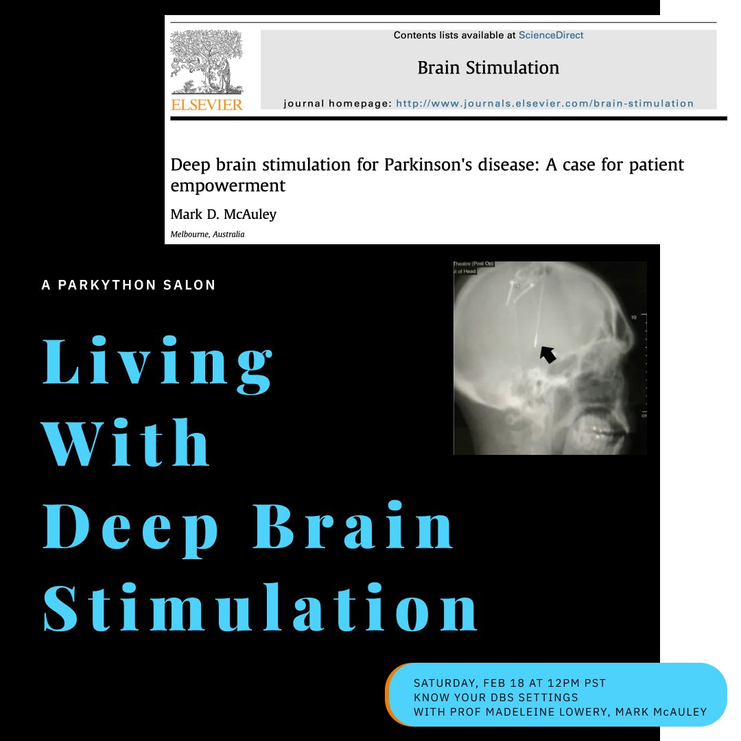 On improving your Deep Brain Stimulation settings...

Join us on Sat, February 18 at 12pm PST for a virtual chat with Prof. Madeleine Lowery, <a href="/MarkMcAuley7/">Mark McAuley</a>, &amp; other folks with DBS about what goes on after the initial implant surgery. 

Sign up: us06web.zoom.us/meeting/regist…