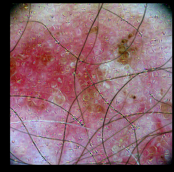 variint's tweet image. Day 52: Lot's of stuff happened, I moved to Singapore! Finally back in coding mode, I have been working on the visualisation of DecentNet. I really need different data, not a fan of melanoma since I don't know enough about pathologies. Anyways, it seems to work! #100DaysOfCode