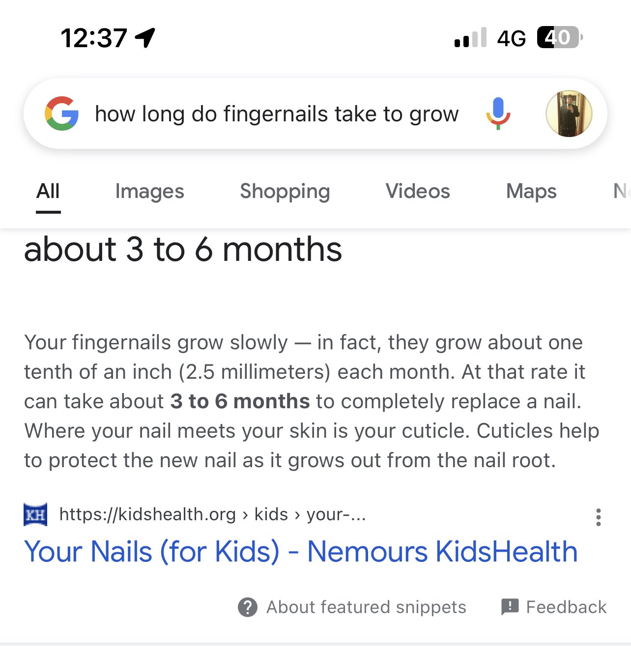 Geo on Twitter "I still can't believe I ripped half of my fingernail