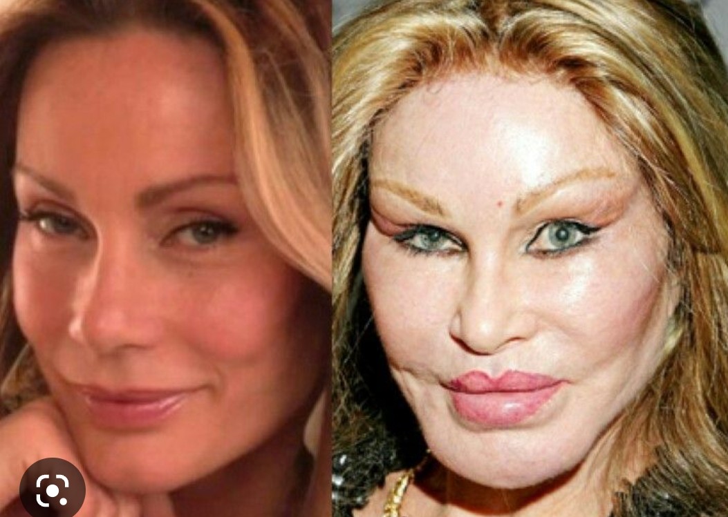 OMG! 😱 PEEPS.. did @Madonna use Jocelyn Wildenstein's 'The Cat Lady' plastic surgeon? 😳🤯🤯.. certainly
 L👀KS that way 🤦🏻.. #RT 

@TMZ @TMZLive @CharlieNeff @InsideEdition @OnlineEt @HarveyLevinTMZ @HeatherMcDonald @tiktok_us @EW @people @usweekly @nypost @Twitter @TwitterNYC