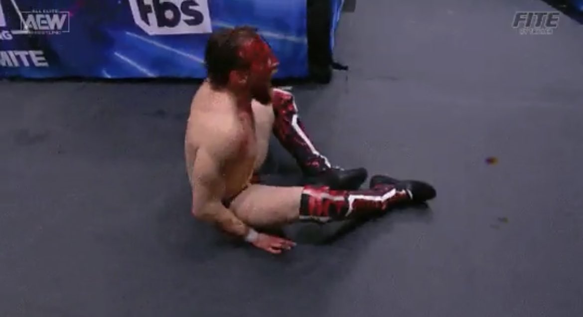 tylernoir's tweet photo. Unintentional blood splatter onto the camera lens is why I tune in. Exquisite: 

#AEWDynamite https://t.co/wOUCb7kL0B