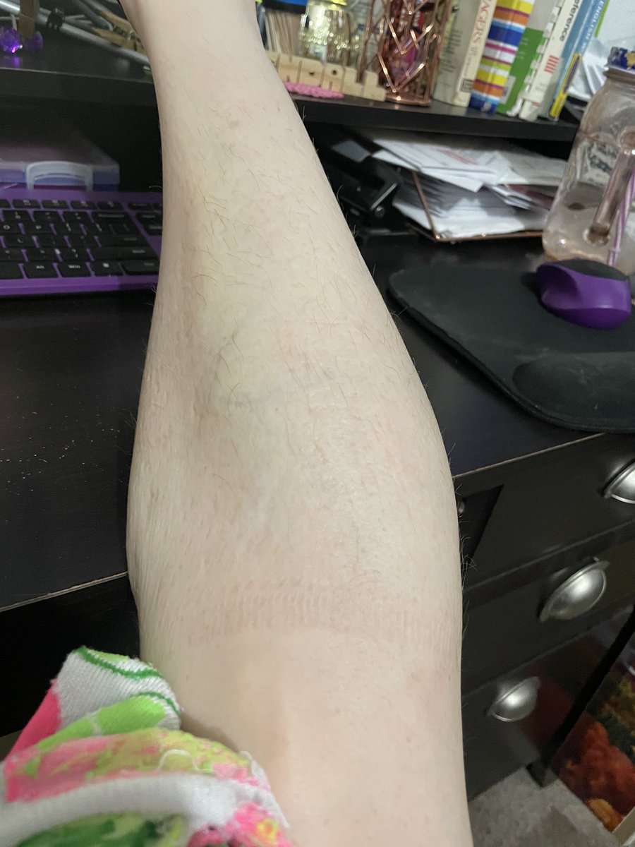 KendallBeckloff's tweet photo. When you wear that pair of socks all day because itโs cold. #ParaLove #ParaLife #SoWeird๐ง๐ #INeedToShave #ButItCold https://t.co/0uWGxTcoPp