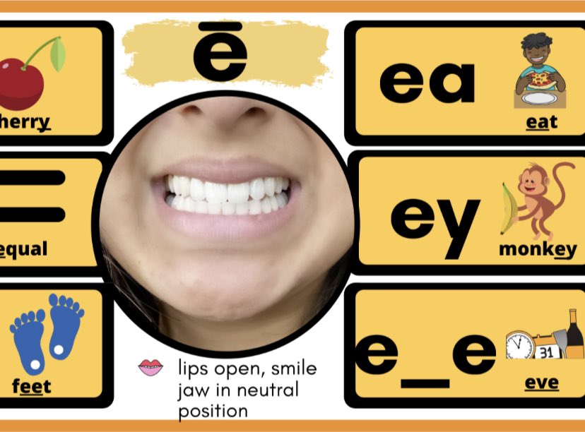 Today, a student asked me if I could autograph their #soundwall 😂

That’s right folks! My braces in grade 5 came in handy for my gig as a mouth model for the <a href="/TVDSBslp/">TVDSB Speech-Language Pathology Services</a> cards you’ve got in your classrooms! 

Available on your local consonant, digraph, and long vowel sound cards😉