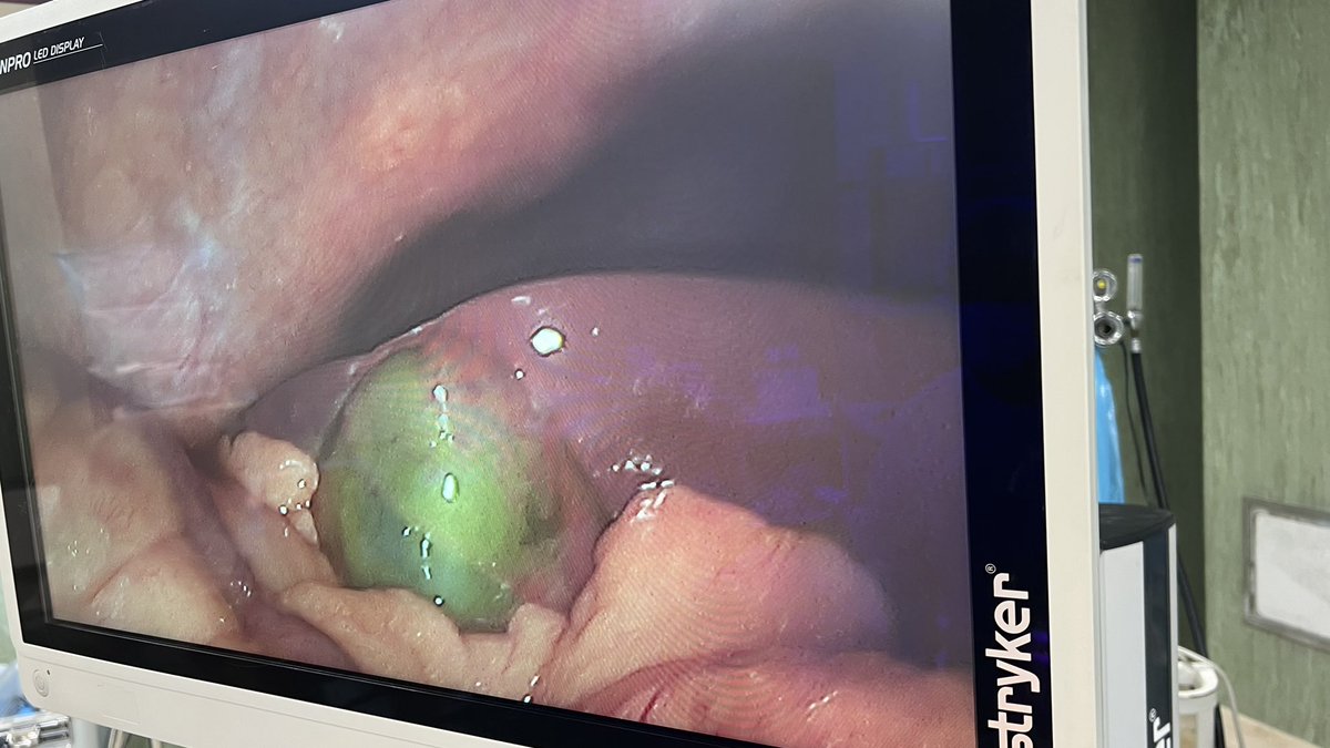 MuftahBoughrara's tweet photo. Gangrenous GB 🥺 #laparoscopic_cholecystectomy https://t.co/t8ZXPaMMgA