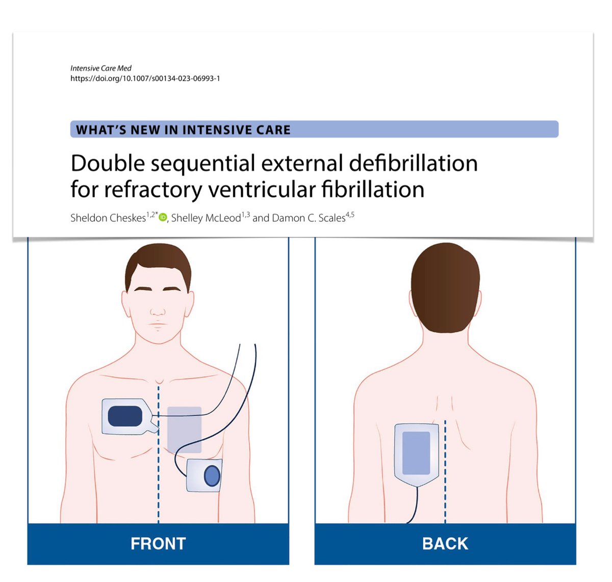 yourICM's tweet photo. 🫀Refractory Vfib
⚡️ vector change defibrillation
⚡️ double sequential external defibrillation
exciting &amp; innovative strategies that can improve survival for patients presenting with refractory VF: time will tell if will be broadly implemented/embraced 
🖇️ https://t.co/uUktOHdGEl https://t.co/aiOtMMX2nT