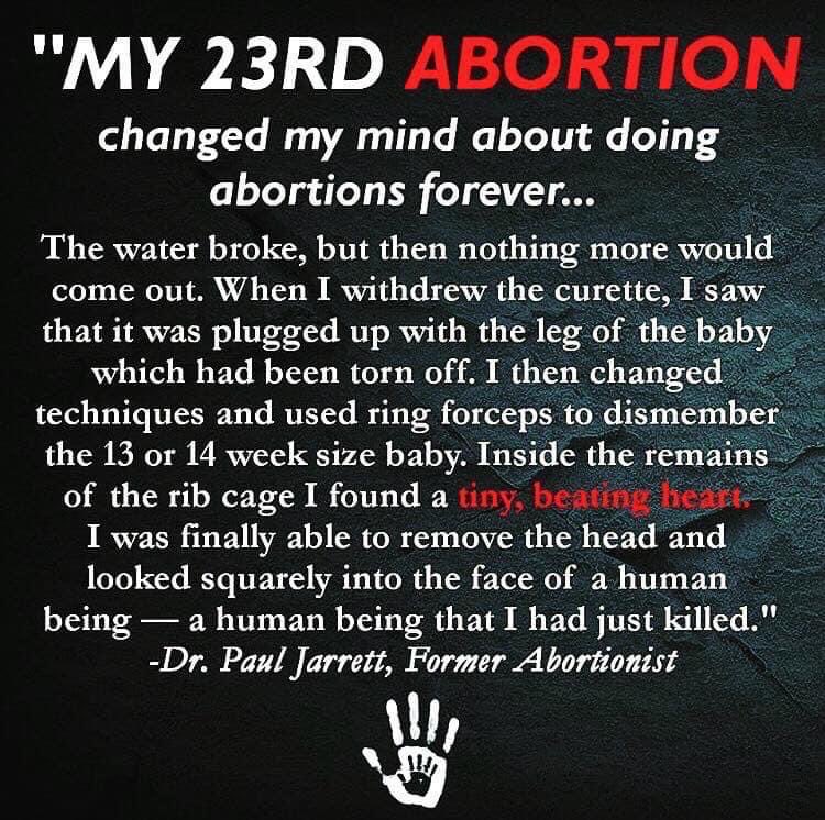 NG4HKfocus's tweet photo. #prolife #foreverchanged #abortion #firstbreath https://t.co/Tcw99mYrmT