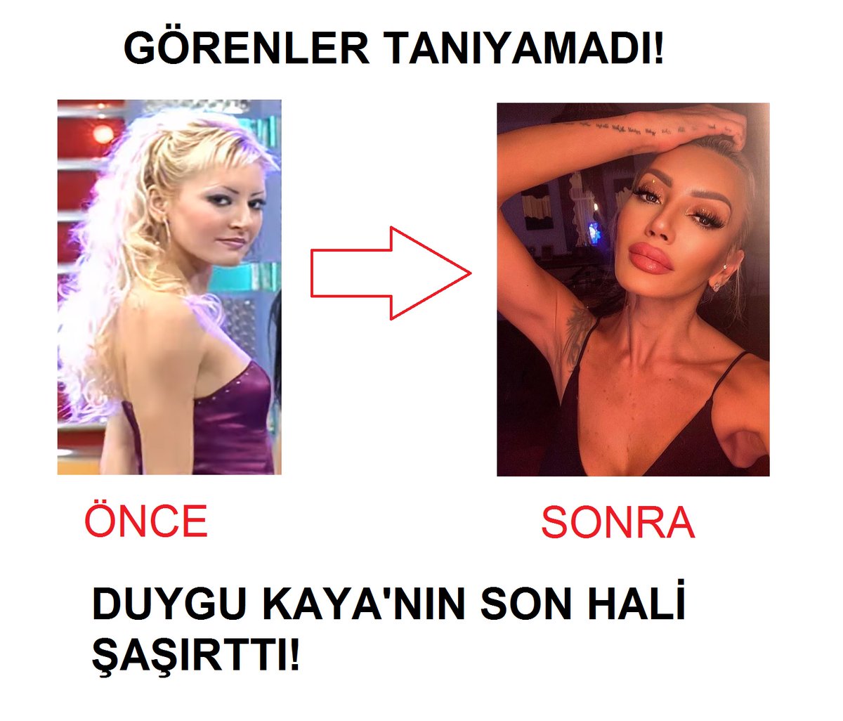 SudeKray's tweet image. #SerdarOrtaçlaBizBize yarışmasının dansçısı Duygu Kaya&apos;nın son hali şaşırttı! Görenler tanıyamadı! 💜💃
#DuyguKaya #dansçı #dansçılar #dansçıkızlar #dansedenkızlar