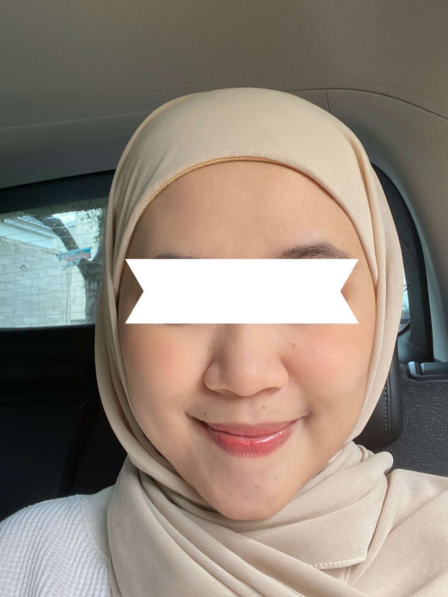 Mamaamiaww's tweet photo. Make up no make up look, flawless finish cuma pake cushion dan bedak tabur✨(st normal to dry)

Skin prep ❌
Foundation ❌
Concealer ❌

Look ini cocok banget buat daily, karena ringan dan fresh.

#racunmakeup #dailymakeup #basicmakeup https://t.co/52vrLqdZ9g
