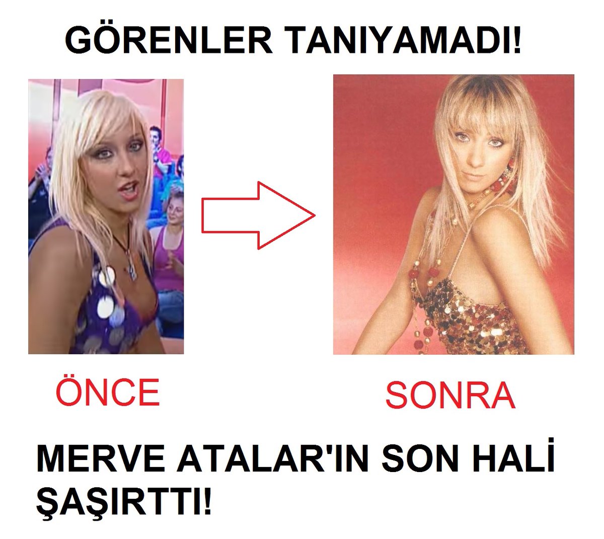 SudeKray's tweet image. Eski #Passaparola dansçısı Merve Atalar&apos;ın son hali şaşırttı! Görenler tanıyamadı! 💃
#MerveAtalar #dansçı #dansçılar #dansçıkızlar #dansedenkızlar