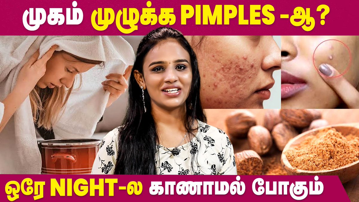 IbcMangai's tweet image. How to get rid of Pimples? | Homemade Packs for Pimples | Pen Nalan | IBC Mangai

WATCH NOW -- youtu.be/PdBrX4l6I10

#pimples #pimplesremedy #pimplesremoval #pennalan #skincare #spottreatment #ibcmangai