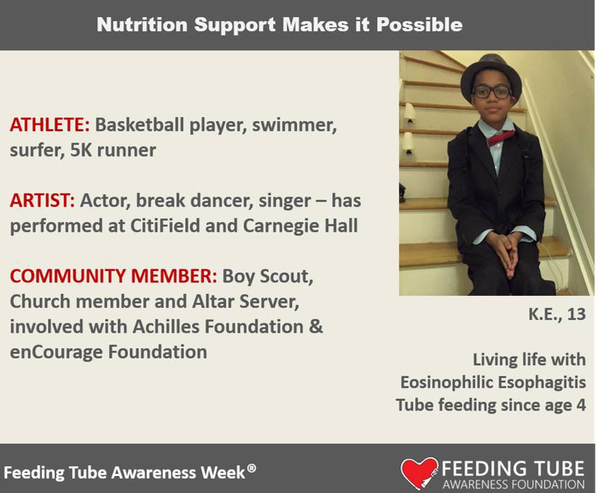 Athlete, artist, Tubie! Nutrition support makes him awesome!  <a href="/juliecjgraham/">Dr. Julie Johnstone</a> <a href="/Sanj_Mahant/">Sanjay Mahant</a> <a href="/stephaniechu_RN/">Stephanie Chu</a> #CanPaedFTAW #FeedingTubeAwarenessWeek