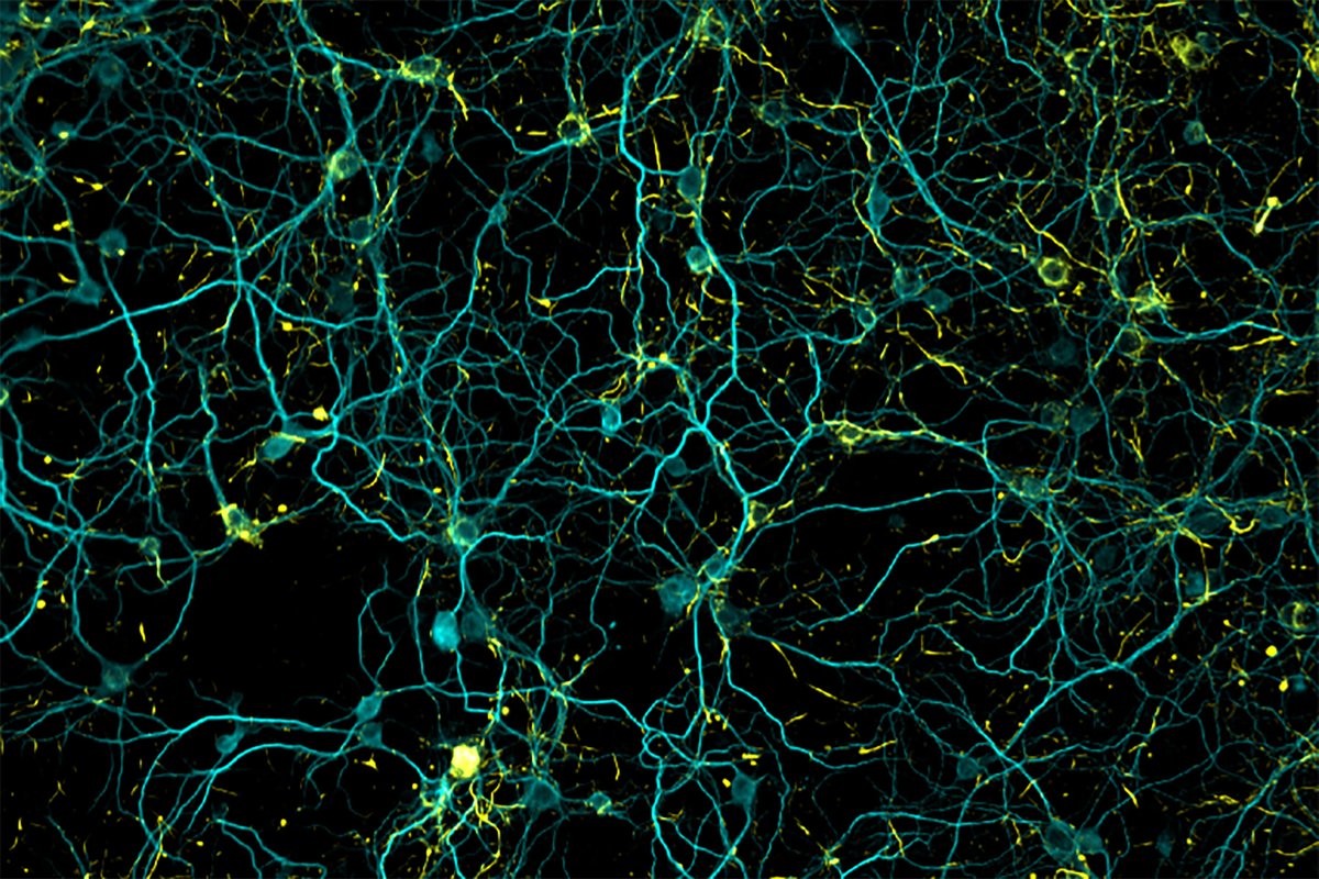 This network of neurons (in blue) is helping the @hnd_lab study #Parkinsons. By understanding what goes wrong on the cellular level, they hope to find ways to impede disease progression — something not possible with current treatments. Learn more at hendersonlab.vai.org