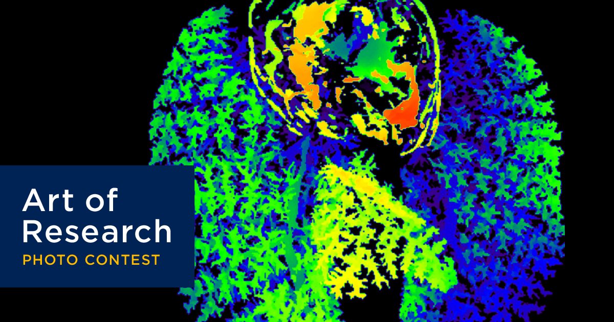 Queen's University (@queensu) on Twitter photo 📸 #Queensu Art of Research category: "Good Health and Wellbeing"
Inspired by <a href="/UN/">United Nations</a> SDGs 1, 2, & 3 to showcase #QueensuResearch that advances our understanding & the improvement of human health & supports the wellbeing of all global citizens
Submit ➡️ bit.ly/3JEqkNy 📸 #Queensu Art of Research category: "Good Health and Wellbeing"
Inspired by <a href="/UN/">United Nations</a> SDGs 1, 2, & 3 to showcase #QueensuResearch that advances our understanding & the improvement of human health & supports the wellbeing of all global citizens
Submit ➡️ bit.ly/3JEqkNy