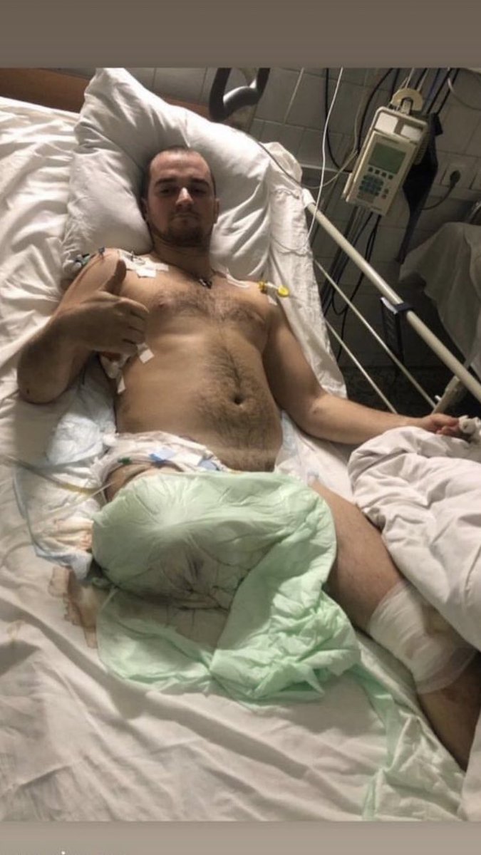 vsheredeha's tweet photo. Богдан втратив праву ногу і отримав поранення в ліву.

згодом у лівому коліні бійця розвинувся артроз, потрібне ендопротезування за свої кошти, бо юридично хвороба набута не на службі.

банка:

https://t.co/VMZP99iDXe https://t.co/T0MWPPj1ti