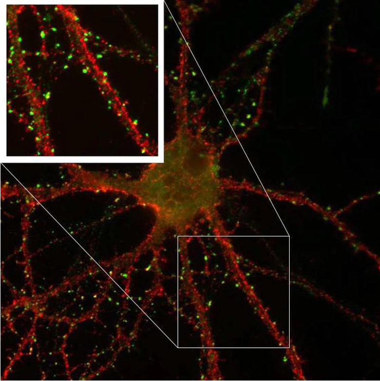 antibodiesinc's tweet photo. With over 800 citations (and counting) our KO validated NeuroMab PSD-95 antibody is the most highly-cited PSD-95 antibody for IHC, ICC, &amp; WB! Learn more about this great product:  https://t.co/I4tB087q7z
#PSD95 #antibody #research https://t.co/AMxzspGgge