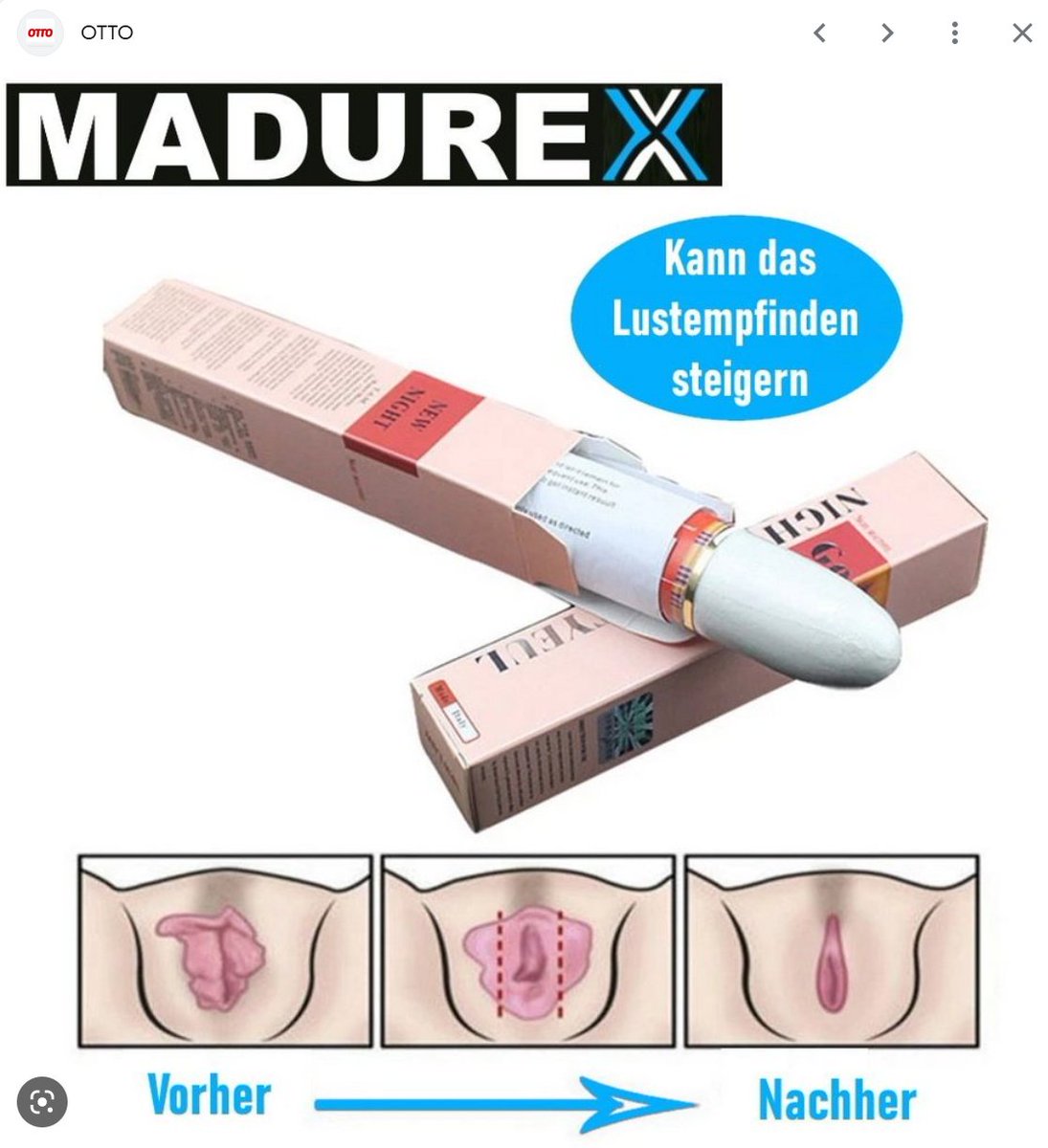 I'm doing some research for my next comic and this ad pops up and it makes me so furious!😬The ad says: if you use this stick, you can train the muscles down there and the ad shows how the labia gets smaller... This isn't how it works! Labia are like earlobes - no muscles😮‍💨