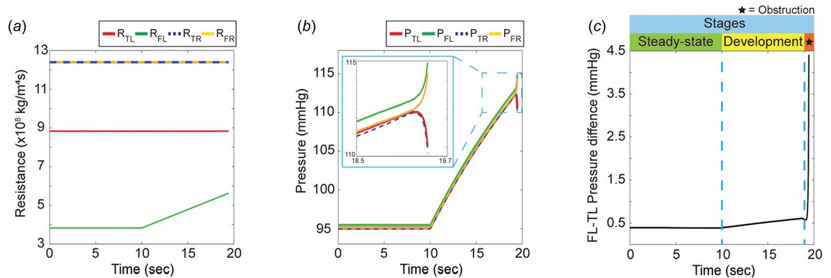 Congrats to 𝐓𝐚𝐞𝐨𝐮𝐤 𝐊𝐢𝐦 and co-authors on their <a href="/JBMEjournal/">JBME Editors</a> paper describing the sudden nature of 𝐃𝐲𝐧𝐚𝐦𝐢𝐜 𝐎𝐛𝐬𝐭𝐫𝐮𝐜𝐭𝐢𝐨𝐧 in Type B #AorticDissection

asmedigitalcollection.asme.org/biomechanical/…

<a href="/BakelPieter/">Pieter van Bakel</a> <a href="/NiteshNama6/">Nitesh Nama</a> @nickburrisMD 

<a href="/umichCVC/">U-M Health Frankel CVC</a> <a href="/UMBME/">U-M BME</a> <a href="/UoMVascSurgery/">UoM Vascular Surgery</a>