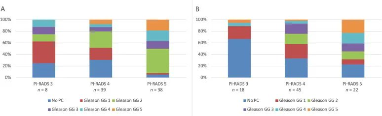 Highlight: Detection of Clinically Significant Prostate Cancer Using Targeted Biopsy with Four Cores Versus Target Saturation Biopsy with Nine Cores in Transperineal Prostate Fusion Biopsy: A Prospective Randomized Trial 

buff.ly/3RN6jGS 

#prostatecancer #UroSoMe