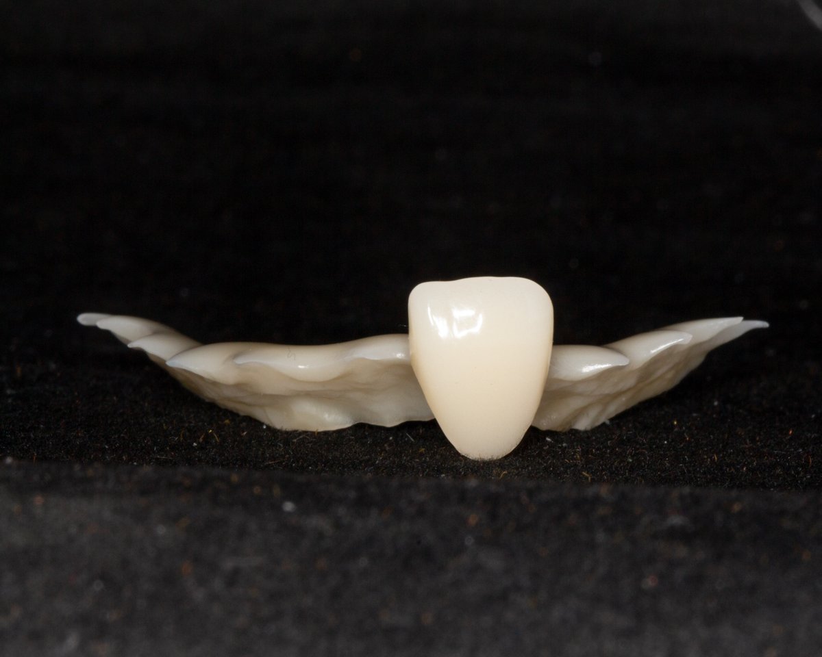 A flipper is a temporary tooth often used to fill in spaces in a smile while the patient prepares for something more definitive.  

A milled flipper is machined from a solid block of PMMA which gives the prosthesis a little extra durability.